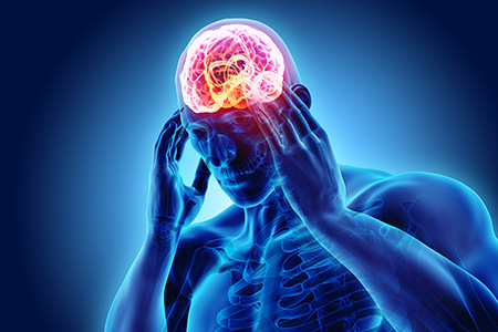 Episodic Migraine: Reasons to Not Ignore Them